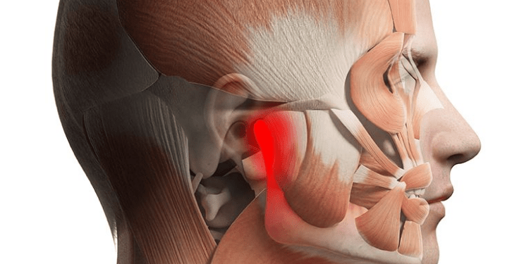 Temporomandibular Joint Dysfunction